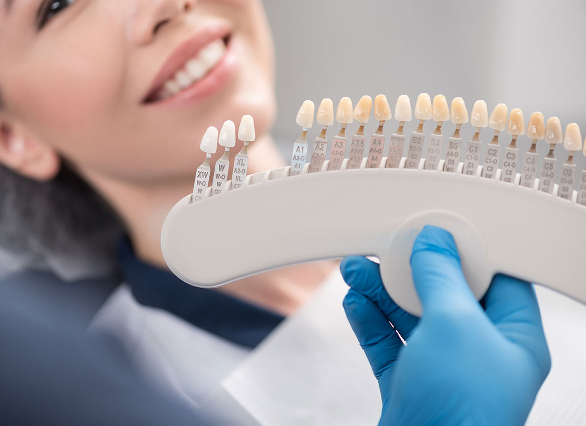 dentist showing veneers to a patient