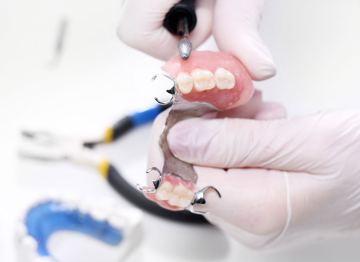 dentures example