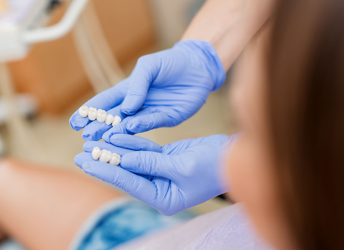 dentist showing bridges to patient